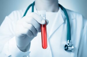 A doctor holds a red vial that might make someone wonder how long does heroin stay in your system