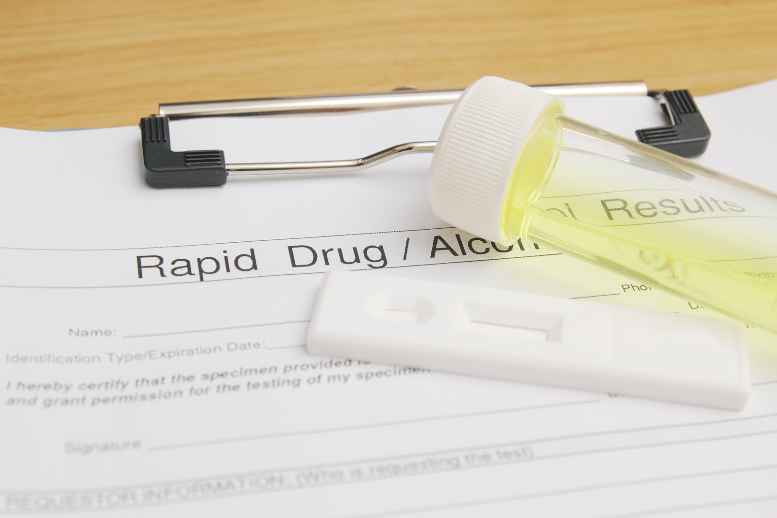 How Long Do Drug Test Results Take? Screening & Detection Windows